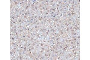 Immunohistochemistry of paraffin-embedded Rat liver using SNW1 Polyclonal Antibody at dilution of 1:100 (40x lens). (SNW1 Antikörper)