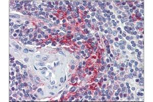 Human Spleen (formalin-fixed, paraffin-embedded) stained with VAV3at 5 µg/ml followed by biotinylated anti-goat IgG secondary antibody, alkaline phosphatase-streptavidin and chromogen. (VAV3 Antikörper  (Internal Region))