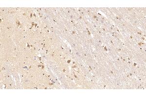 Immunohistochemistry (IHC) image for anti-Tenascin C (TNC) (AA 49-181) antibody (ABIN7426415)