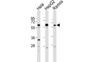 All lanes : Anti-GRK5 Antibody  at 1:2000 dilution Lane 1: Hela whole cell lysates Lane 2: HepG2 whole cell lysates Lane 3: Ramos whole cell lysates Lysates/proteins at 20 μg per lane. (GRK5 Antikörper  (C-Term))
