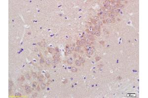 Immunohistochemistry (IHC) image for anti-ADAM Metallopeptidase with thrombospondin Type 1 Motif, 5 (ADAMTS5) (AA 511-610) antibody (ABIN701005)