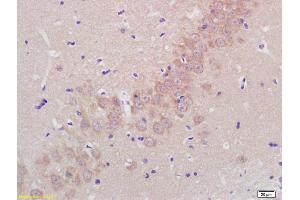 Formalin-fixed and paraffin embedded rat brain labeled with Rabbit Anti Aggrecanase-2/ADAMTS5 Polyclonal Antibody, Unconjugated (ABIN701005) at 1:200 followed by conjugation to the secondary antibody and DAB staining (ADAMTS5 Antikörper  (AA 511-610))