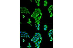 Immunofluorescence analysis of U2OS cells using NOL3 antibody (ABIN6132415, ABIN6144704, ABIN6144706 and ABIN6221927). (NOL3 Antikörper  (AA 1-208))