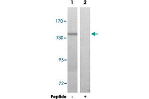 Western blot analysis of extracts from HUVEC cells, using COL20A1 polyclonal antibody . (COL20A1 Antikörper  (C-Term))