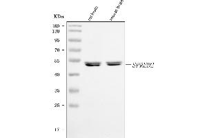 Western blot analysis of SPRED2 using anti-SPRED2 antibody (ABIN7601643).