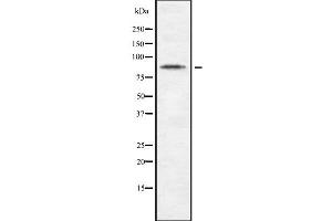 Western blot analysis of CDH10 using Jurkat whole cell lysates (CDH10 Antikörper  (C-Term))