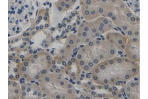 Detection of TGFb1 in Mouse Kidney Tissue using Polyclonal Antibody to Transforming Growth Factor Beta 1 (TGFb1) (TGFB1 Antikörper  (AA 279-390))