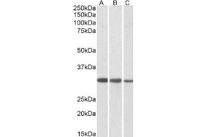 Western Blotting (WB) image for anti-Capping Protein (Actin Filament) Muscle Z-Line, beta (CAPZB) antibody (ABIN5907201) (CAPZB Antikörper)