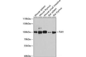 Western blot analysis of extracts of various cell lines using TLR1 Polyclonal Antibody at dilution of 1:1000. (TLR1 Antikörper)