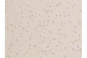 ABIN6267244 at 1/100 staining mouse brain tissue sections by IHC-P.