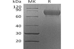 Western Blotting (WB) image for Cell Adhesion Molecule 1 (CADM1) (AA 48-388) protein (His tag) (ABIN7320845)