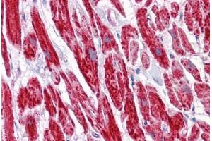 Human Heart: Formalin-Fixed, Paraffin-Embedded (FFPE)