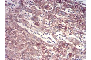 Immunohistochemistry (IHC) image for anti-Transthyretin (TTR) (AA 1-147) antibody (ABIN5875576) (TTR Antikörper  (AA 1-147))