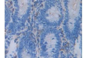 DAB staining on IHC-P; Samples: Rat Intestine Tissue (Acrosin Antikörper  (AA 43-291))