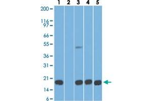 Western blot analysis of Lane 1: human stomach tissue lysate in the absence of immunizing peptide, Lane 2: human stomach tissue lysate in the presence of immunizing peptide, Lane 3: mouse stomach tissue lysate, Lane 4: rat stomach tissue lysate and Lane 5: HCT-116 cell lysate with AGR2 monoclonal antibody, clone IMG10E2  at 5 ug/mL working concentration. (AGR2 Antikörper  (AA 50-100))