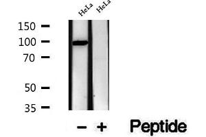 Western blot analysis of extracts of HeLa cells, using VPS16 antibody. (VPS16 Antikörper  (Internal Region))