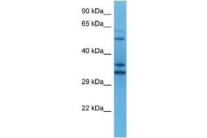 Host:  Rabbit  Target Name:  TEAD2  Sample Tissue:  Human U937 Whole Cell  Antibody Dilution:  1ug/ml (TEAD2 Antikörper  (N-Term))