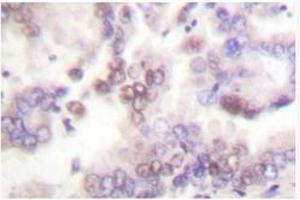 Image no. 1 for anti-Cyclin-Dependent Kinase Inhibitor 2B (p15, Inhibits CDK4) (CDKN2B) antibody (ABIN271760) (CDKN2B Antikörper)