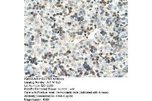 Rabbit Anti-HSD17B6 Antibody  Paraffin Embedded Tissue: Human Liver Cellular Data: Hemopoietic Antibody Concentration: 4. (HSD17B6 Antikörper  (N-Term))
