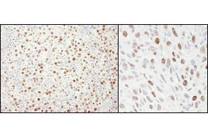 Immunohistochemistry (IHC) image for anti-Minichromosome Maintenance Deficient 4 (MCM4) (AA 750-800) antibody (ABIN7454513)