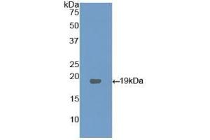 Detection of Recombinant LPCAT3, Human using Polyclonal Antibody to Lysophosphatidylcholine Acyltransferase 3 (LPCAT3) (LPCAT3 Antikörper  (AA 122-233))