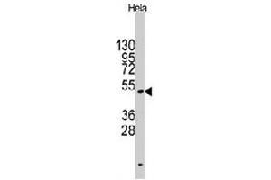 Western blot analysis of CD4 polyclonal antibody  in HeLa cell line lysates (35 ug/lane).