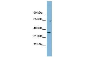 RanGAP1 antibody used at 1 ug/ml to detect target protein.