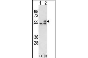 Western blot analysis of ATP5B (arrow) using rabbit polyclonal ATP5B Antibody (Center) (ABIN650786 and ABIN2839558). (ATP5B Antikörper  (AA 135-163))