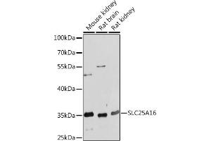 Western blot analysis of extracts of various cell lines, using SLC25 Rabbit pAb (ABIN7270432) at 1:1000 dilution.