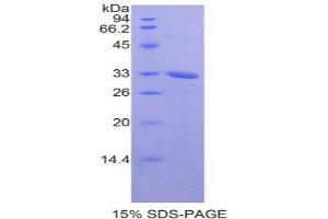 SDS-PAGE analysis of Mouse NEK2 Protein. (NEK2 Protein)