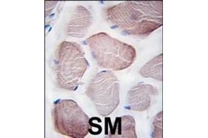 Formalin-fixed and paraffin-embedded human skeletal muscle tissue reacted with hPI3KC3 (C-term) (ABIN388591 and ABIN2849999) , which was peroxidase-conjugated to the secondary antibody, followed by DAB staining. (PIK3C3 Antikörper  (C-Term))