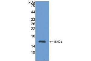 Western blot analysis of recombinant Human MT1. (MT1 Antikörper  (AA 1-61))