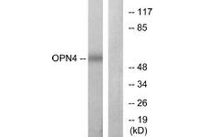 Western blot analysis of extracts from COLO cells, using OPN4 Antibody.