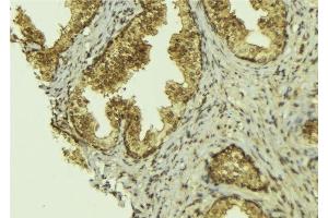ABIN6276517 at 1/100 staining Mouse colon tissue by IHC-P.