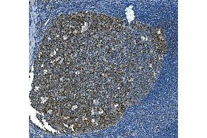 IHC analysis of MCM2 using anti-MCM2 antibody (ABIN7601594). (MCM2 Antikörper  (AA 393-850))