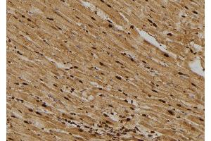 ABIN6276385 at 1/100 staining Rat heart tissue by IHC-P.