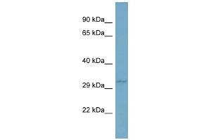 Western Blotting (WB) image for anti-Tumor Necrosis Factor (Ligand) Superfamily, Member 13b (TNFSF13B) (N-Term) antibody (ABIN2787732)