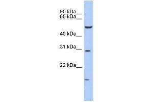 WB Suggested Anti-HOXC5 Antibody Titration: 0. (Homeobox C5 Antikörper  (Middle Region))