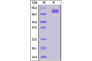 Biotinylated SARS-CoV-2 S2 protein, His,Avitag™ on  under reducing (R) condition. (SARS-CoV-2 Spike S2 Protein (His tag,AVI tag,Biotin))