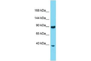 Western Blotting (WB) image for anti-Ring Finger Protein 216 (RNF216) (N-Term) antibody (ABIN2774202) (RNF216 Antikörper  (N-Term))