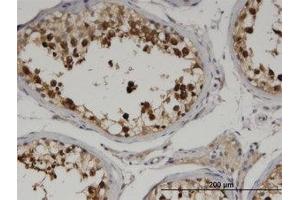 Image no. 1 for anti-Cytoskeleton Associated Protein 2 (CKAP2) (AA 1-162) antibody (ABIN599549) (CKAP2 Antikörper  (AA 1-162))