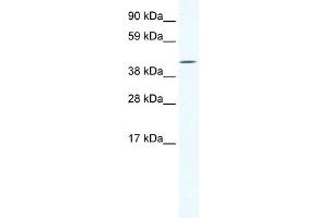 WB Suggested Anti-IRX6 Antibody Titration:  1. (IRX6 Antikörper  (C-Term))