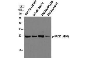 Western Blot (WB) analysis of Mouse Kidney Mouse Brain Mouse Spleen Mouse Lung using p-FADD (S194) antibody.
