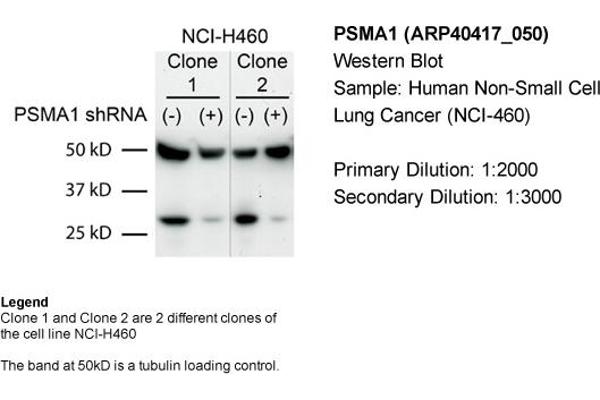 PSMA1 Antikörper  (C-Term)