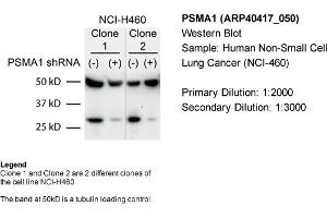 Sample Type: Human non-small cell lung cancer (NCI-460)Primary Dilution: 1:2000Secondary Dilution: 1:300050kDa band is a tubulin loading control band (PSMA1 Antikörper  (C-Term))