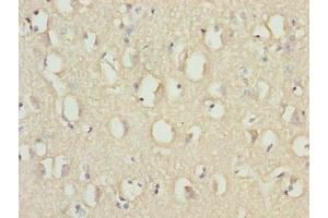 Immunohistochemistry of paraffin-embedded human brain tissue using ABIN7167001 at dilution of 1:100