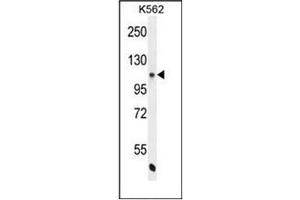 Western blot analysis of NOS3 Antibody  in K562 cell line lysates (35ug/lane). (ENOS Antikörper  (AA 1163-1191))