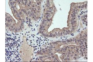Image no. 2 for anti-RAB21, Member RAS Oncogene Family (RAB21) antibody (ABIN1500541)