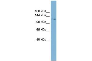 WB Suggested Anti-TTC17 Antibody Titration: 0. (TTC17 Antikörper  (N-Term))