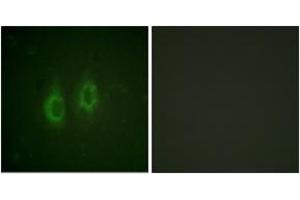 Immunofluorescence analysis of HeLa cells, using Connexin 43 (Ab-261) Antibody. (Connexin 43/GJA1 Antikörper  (AA 226-275))